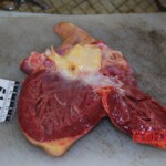 Autopsy of Chinese woman