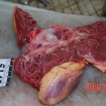 Autopsy of Chinese woman