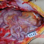 Autopsy of Chinese woman