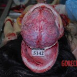 Autopsy of Chinese woman