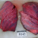 Autopsy of Chinese woman