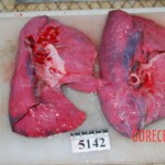 Autopsy of Chinese woman