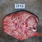 Autopsy of Chinese woman