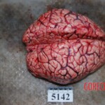 Autopsy of Chinese woman