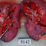 Autopsy of Chinese woman