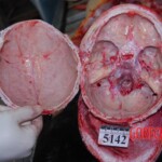 Autopsy of Chinese woman