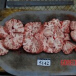 Autopsy of Chinese woman