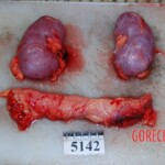 Autopsy of Chinese woman