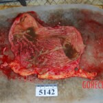 Autopsy of Chinese woman