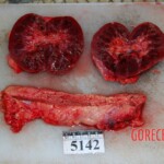 Autopsy of Chinese woman