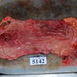 Autopsy of Chinese woman