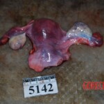Autopsy of Chinese woman