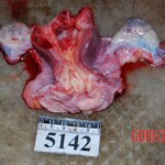 Autopsy of Chinese woman