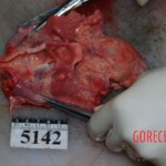 Autopsy of Chinese woman