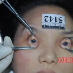 Autopsy of Chinese woman