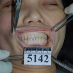 Autopsy of Chinese woman