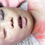 Autopsy of Chinese girl