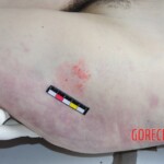 Autopsy of Chinese girl