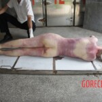 Autopsy of Chinese girl