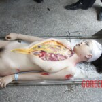 Autopsy of Chinese girl