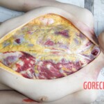 Autopsy of Chinese girl