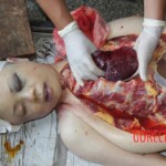 Autopsy of Chinese girl