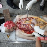 Autopsy of Chinese girl