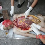 Autopsy of Chinese girl