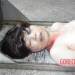 Autopsy of Chinese girl