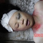 Autopsy of Chinese girl