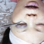 Autopsy of Chinese girl
