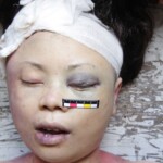 Autopsy of Chinese girl