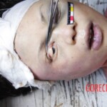 Autopsy of Chinese girl