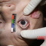 Autopsy of stabbed girl