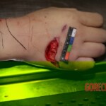 Autopsy of stabbed girl