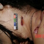 Autopsy of stabbed girl