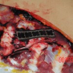 Chinese woman stabbed to death