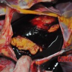 Chinese woman stabbed to death