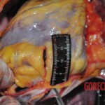 Chinese woman stabbed to death