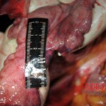 Chinese woman stabbed to death