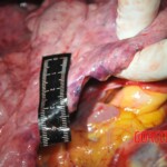 Chinese woman stabbed to death