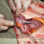 Chinese woman stabbed to death