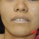 Stabbed woman in morgue