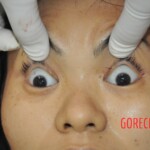 Stabbed woman in morgue