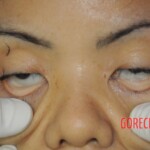 Stabbed woman in morgue