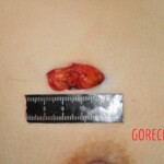 Stabbed woman in morgue