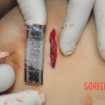 Stabbed woman in morgue