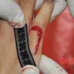 Stabbed woman in morgue