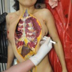 Stabbed woman in morgue