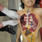 Stabbed woman in morgue